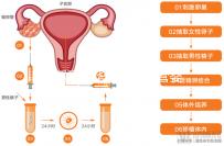 玉溪到昆華醫院做試管嬰兒怎么樣？詳細費用明細如下