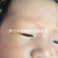 牢記子宮康4大注意事項(xiàng)，輕松避免胃脹、腹瀉等副作用