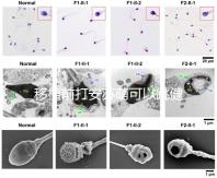 移植前打安蘇萌可以跳健身操嗎？你得到了嗎？
