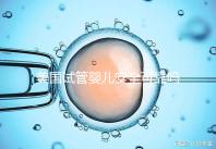 美國試管嬰兒安全可靠嗎？了解基本原理和安全性？