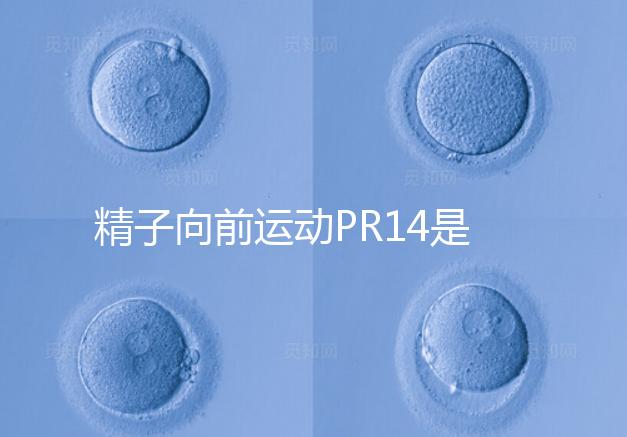 精子向前運動PR14是否正常聽專家怎么說，當心弱精找上門