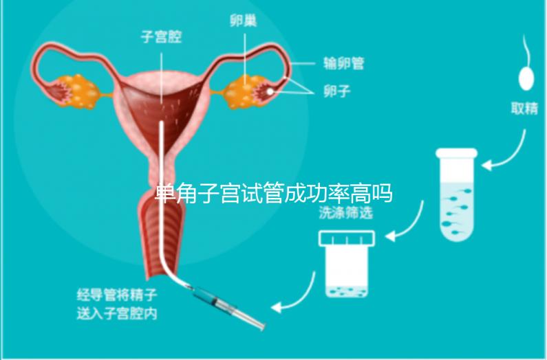 單角子宮試管成功率高嗎？送你5招降低胚胎著床的難度
