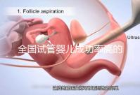 全國試管嬰兒成功率高的醫(yī)院排名，內(nèi)附2023試管費用及成功率參考