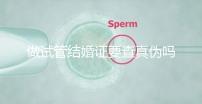 做試管結(jié)婚證要查真?zhèn)螁幔ㄗ鲈嚬芙Y(jié)婚證要查真?zhèn)螁岫嗌馘X）