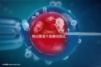 做試管是不是要結婚證，做試管需要結婚證