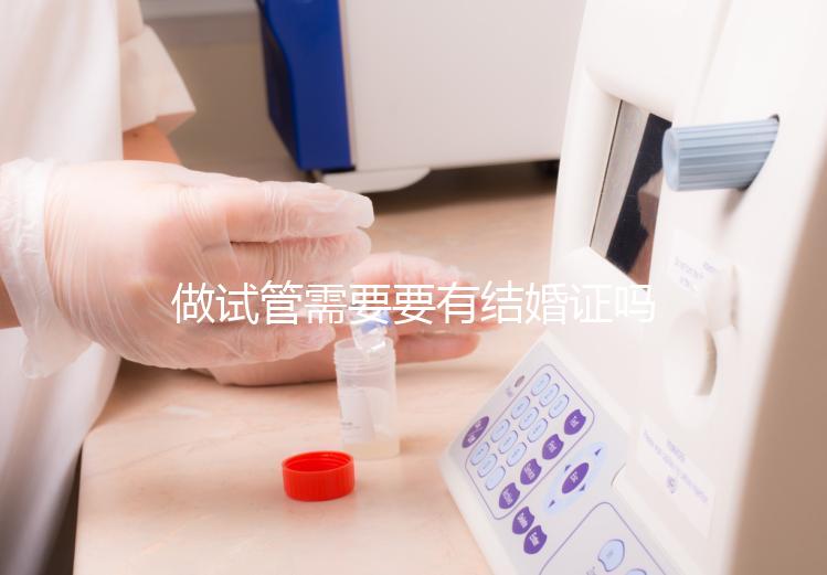 做試管需要要有結婚證嗎？做試管需要結婚證