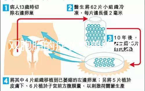 雙胞胎的癥狀和單胎有太多不一樣，被蒙在鼓里還不知道