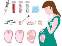 辦準(zhǔn)生證沒必要隱瞞生育史，女方再婚需帶離婚證