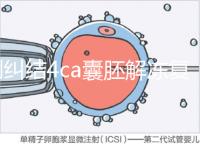 別糾結4ca囊胚解凍復蘇最早幾天能測出了，著床率先了解下
