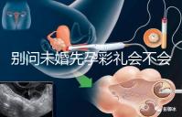 別問未婚先孕彩禮會不會少了，一分不給也不無可能