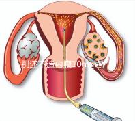 別還不造內(nèi)膜10mm鮮胚容不容易著床，能否移植看這幾點