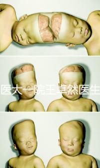 哈醫大一院王卓然醫生試管攻略,坐診時間、成功率早知道