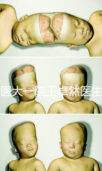 哈醫大一院王卓然醫生試管攻略,坐診時間、成功率早知道