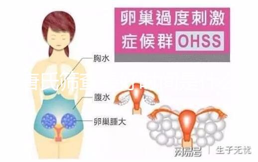 唐氏篩查最好時間是什么時候，內蒙古單項費用不超三百