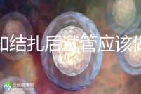 告知結扎后試管應該做什么準備，是否有照片檢查，有答案