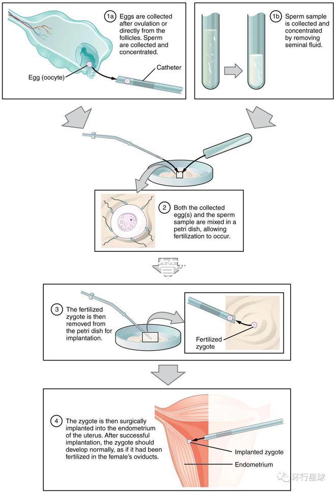 國內首起試管嬰兒案例，法律竟難以給患者維權