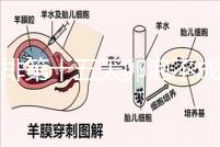 促排第十五天卵泡不成熟還可以治療!1.2等幾天就能長(zhǎng)大