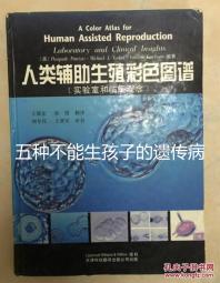 五種不能生孩子的遺傳病大公開，卟啉病能否要寶寶要早知