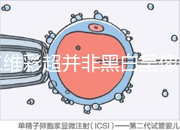 二維彩超并非黑白呈像，通過檢查還能看清胎兒五官