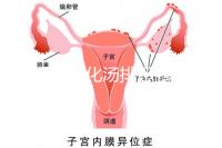 產后喝生化湯排惡露會使寶寶拉肚子？醫生：時間沒用對