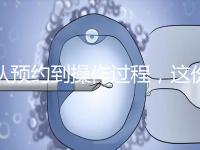 從預約到操作過程，這份tct檢查流程攻略請查收