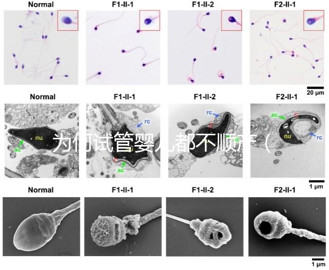 為何試管嬰兒都不順產（為何試管嬰兒都不順產呢）