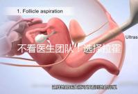 不看醫生團隊！選擇拉霍亞試管嬰兒中心的優勢還有這些