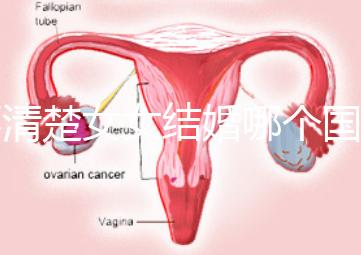 不清楚女女結(jié)婚哪個(gè)國家能領(lǐng)證來看，歐洲這些地區(qū)都可