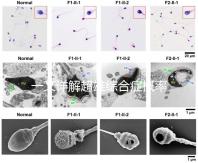 一文詳解超雄綜合癥概率有多大,想造的人多不多看過來