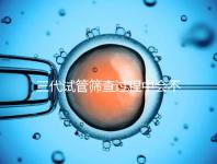 三代試管篩查過程中會不會出現錯誤戳，看完流程就知道