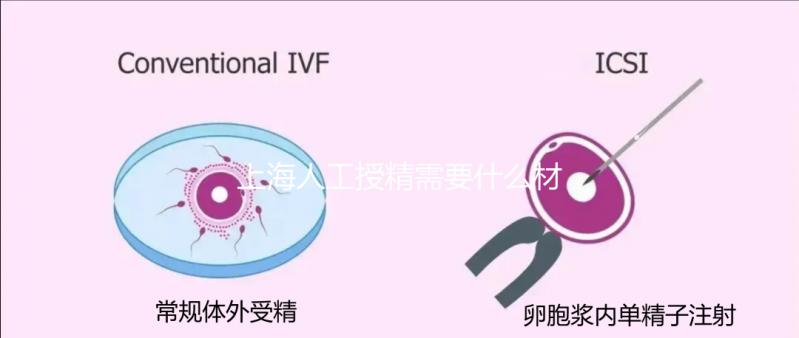 上海人工授精需要什么材料和手續(xù)戳，提前做好準(zhǔn)備很重要