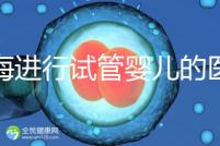 上海進(jìn)行試管嬰兒的醫(yī)院排名