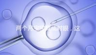兩個月寶寶竟成對眼，這5大形成原因家長必知