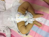 乳腺檢查具體流程提前知曉，看完就診時不再尷尬