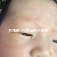 想知道促排期間能不能吃草莓看過來，怎么吃不發胖有講究