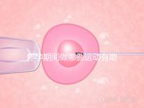 懷孕期間做哪些運(yùn)動(dòng)有助于自然分娩？