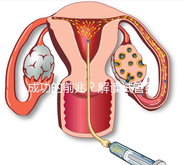 成功的前兆？解讀試管嬰兒移植后為什么容易出汗