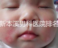 更新本溪男科醫(yī)院排名，不要錯過本溪湖區(qū)top3醫(yī)生的專業(yè)