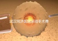 武漢同濟醫(yī)院采精手術(shù)費用分析，顯微采精也可報銷