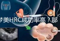 夢美HRC成功率高？那是因為有這些試管嬰兒醫(yī)生