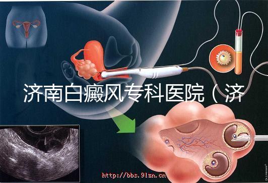 濟南白癜風專科醫院（濟南白點癲風醫院排名）