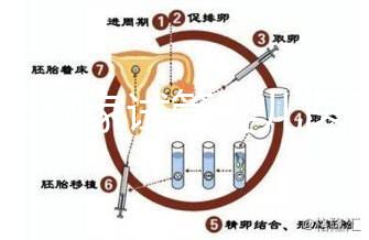 浙江27家試管嬰兒醫(yī)院成功率排名公開(kāi)，邵逸夫醫(yī)院位居前十