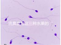 流鼻血與這三種水果的“奇妙”關(guān)系，建議少吃，多補(bǔ)充維生素K可以幫助止血！