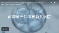 河南第三代試管嬰兒醫院整理，成功率、費用全在這