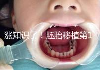 漲知識(shí)了!胚胎移植第12天出血不見得是試管失敗