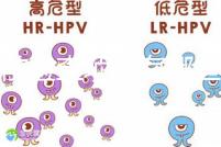 孕前檢查項目有哪些？