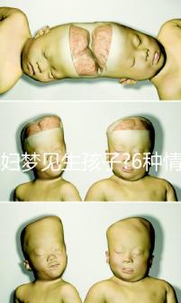 孕婦夢(mèng)見(jiàn)生孩子?6種情形下的寓意各不同