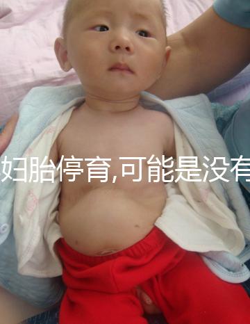 孕婦胎停育,可能是沒有做好沒做好檢查,這3個辦法值得嘗試