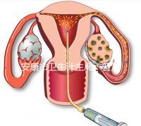 安康市衛生計生局：普及優生優育五項檢查相關知識