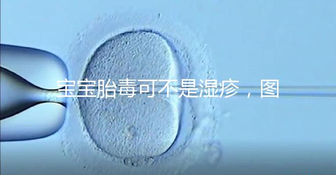 寶寶胎毒可不是濕疹，圖文解讀兩者詳細(xì)區(qū)別